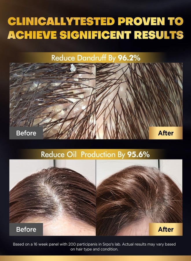 COOLKESI Tripeptide-Infused Hair Growth Biotin Shampoo and Conditioner Set, Onion Anti-Loss Volumizing Moisturizing Treatment for Soft Shine Hair, Dandruff Routine Rosemary Shampoo for Men and Women, 2x16.9oz - Image 5